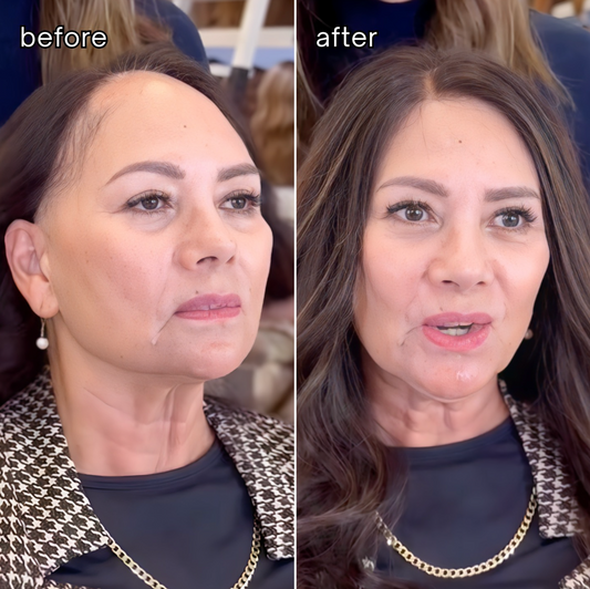 REAL HAIR: Receding Hairline Topper