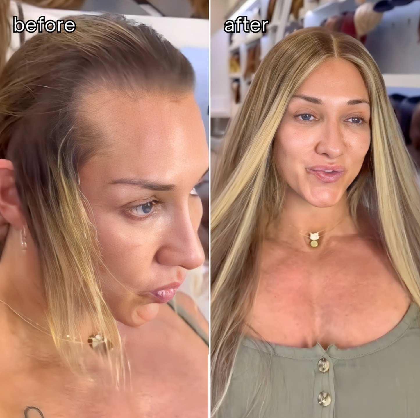 REAL HAIR: Receding Hairline Topper